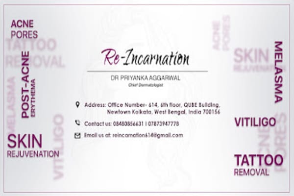 Dr. Priyanka Aggarwal | Best Vitiligo Doctor in Kolkata