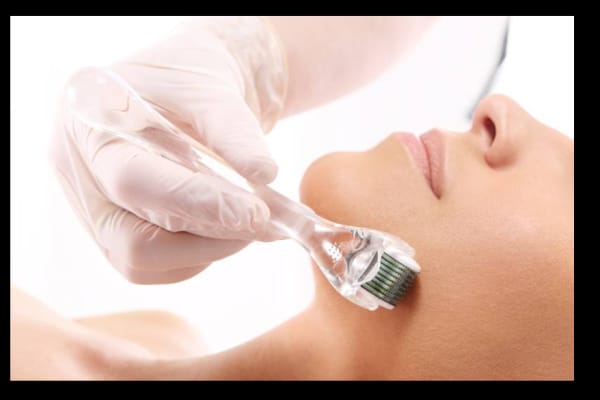 Elation Hair and Skin Clinic | Minto Park
